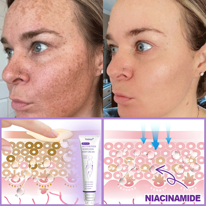 💕 Vitalisys® PDRN Multi-Peptide Massaging Body Roller Cream- Anti-aging, Hydrating, Skin Firming & Lifting, Skin Repair, Even Tone, Acne and Dark Spot Treatment, Wart and Mole Removal, and Psoriasis Relief