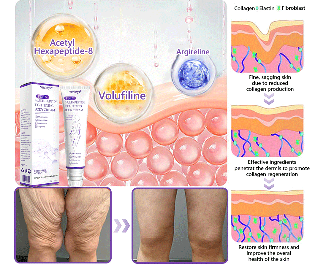 💕 Vitalisys® PDRN Multi-Peptide Massaging Body Roller Cream- Anti-aging, Hydrating, Skin Firming & Lifting, Skin Repair, Even Tone, Acne and Dark Spot Treatment, Wart and Mole Removal, and Psoriasis Relief