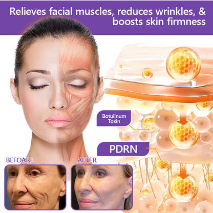 💕 Vitalisys® PDRN Multi-Peptide Massaging Body Roller Cream- Anti-aging, Hydrating, Skin Firming & Lifting, Skin Repair, Even Tone, Acne and Dark Spot Treatment, Wart and Mole Removal, and Psoriasis Relief