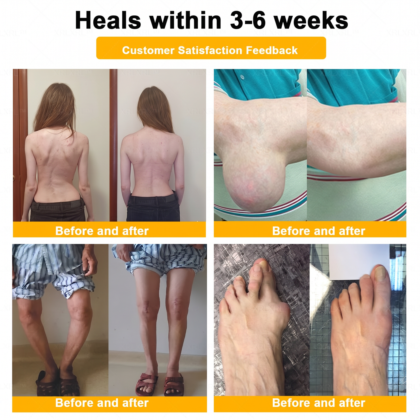 30% OFF 🎁🎁 | 𝐌𝐔𝐑𝐖𝐎𝐍® Bee Venom Balm for Pain Relief & Bone Healing ✨