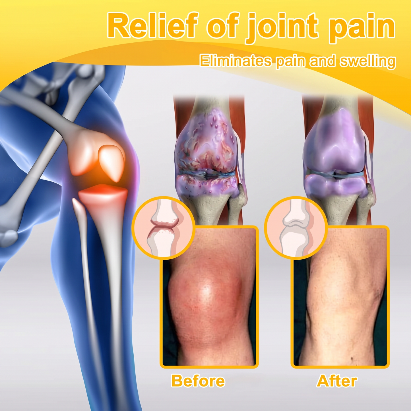 30% OFF 🎁🎁 | 𝐌𝐔𝐑𝐖𝐎𝐍® Bee Venom Balm for Pain Relief & Bone Healing ✨
