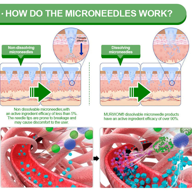 𝑵𝒂𝒕𝒖𝒓𝒂𝒍 𝑴𝒆𝒅𝒊𝒄𝒂𝒍 𝑭𝒐𝒓𝒎𝒖𝒍𝒂👩‍⚕️| 𝙈𝑼𝐑𝒲𝓞𝙽® 𝑴-𝑩 -𝙉 𝟭𝟬-𝙞𝓷-𝟏 𝙉𝙖𝙣𝒐 𝑭𝓾𝙨𝙞𝙤𝙣 𝙈𝓮𝓽𝙖𝙗𝙤𝒍𝒊𝓬 𝑷𝒂𝒕𝓬𝙝 |✨𝘉𝘢𝘤𝘬𝘦𝘥 𝘣𝘺 𝘴𝘤𝘪𝘦𝘯𝘤𝘦 | 10-𝗂𝗇-𝟣 𝖿𝗈𝗋𝗆𝗎𝗅𝖺 | 𝑅𝑒𝑠𝑢𝑙𝑡𝑠 𝑖𝑛 7 𝑑𝑎𝑦𝑠🥦