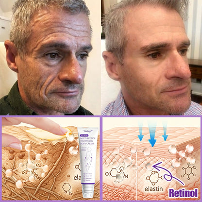 💕 Vitalisys® PDRN Multi-Peptide Massaging Body Roller Cream- Anti-aging, Hydrating, Skin Firming & Lifting, Skin Repair, Even Tone, Acne and Dark Spot Treatment, Wart and Mole Removal, and Psoriasis Relief